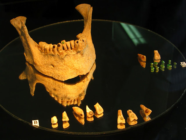 Teeth on display with embedded jewels