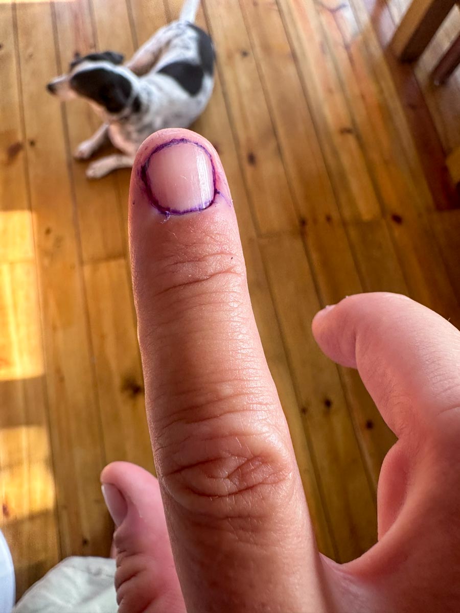 Election ink after cleaning with bleach